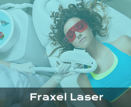 Informationen zu Fraxel Laser